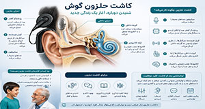 دستگاه کاشت حلزون گوش و نحوه عملکرد پردازشگر کاشت حلزون