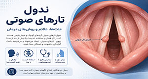 ندول تارهای صوتی و روش‌های ارزیابی و درمان