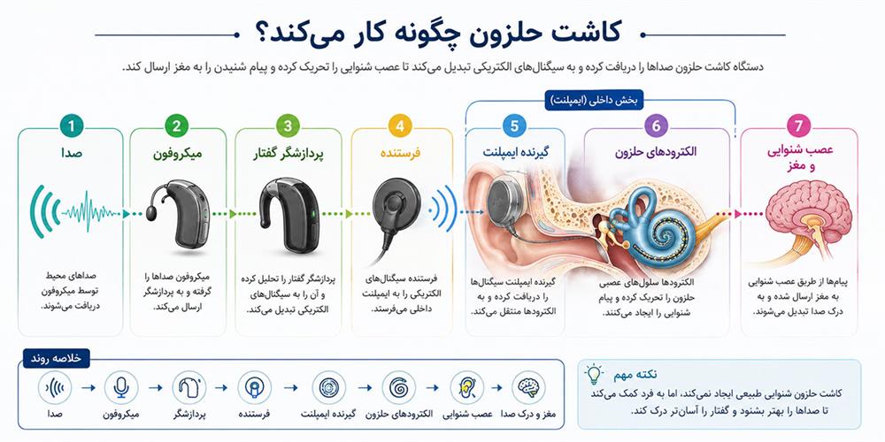 اینفوگرافیک نحوه عملکرد کاشت حلزون گوش و انتقال صدا به عصب شنوایی