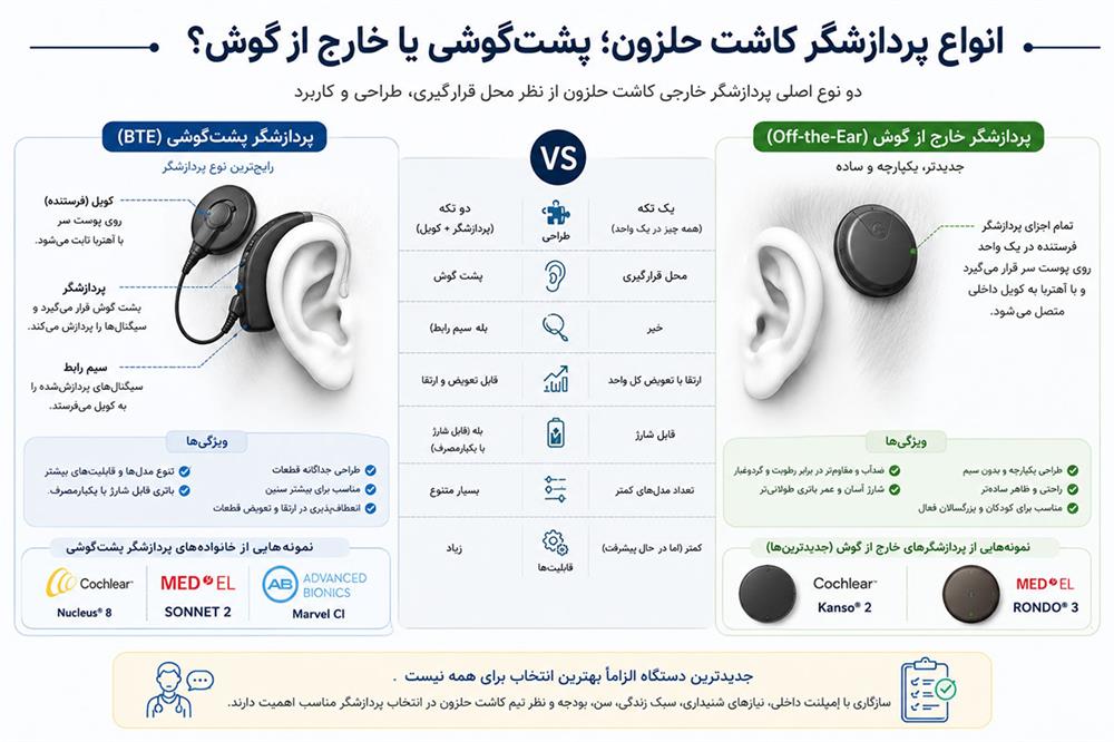 مقایسه انواع پردازشگر کاشت حلزون پشت&zwnj;گوشی و خارج از گوش Kanso و RONDO